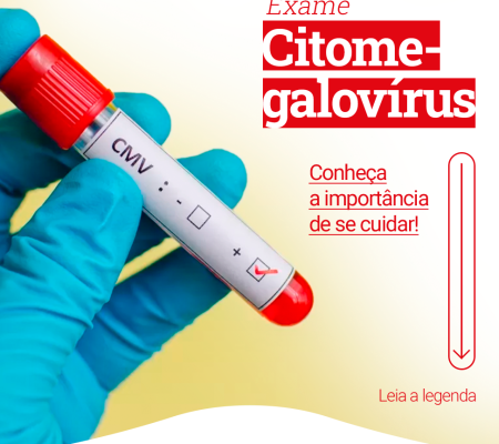 Citomegalovírus